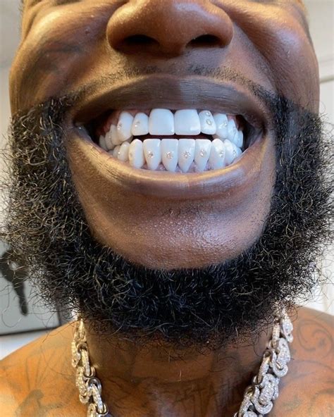 gucci maine teeth|who did Gucci Mane sign.